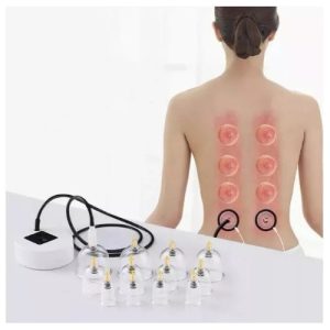 Masajeador Ventosas Set Vacumterapia 12 Copas Al Vacio Blanco